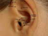 auriculoterapia-puntos